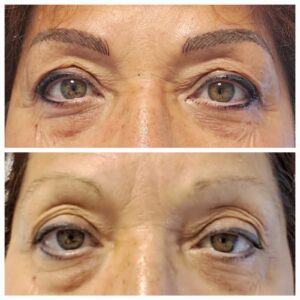 micropigmentacion ojos en barcelona tarragona